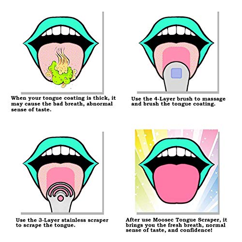 מגרד לשון, היפטר מלשון לבנה, מנקה גאנק ללא BPA הפחיתו נשימה רעה כיתה רפואית נירוסטה ניקוי לשון לשון